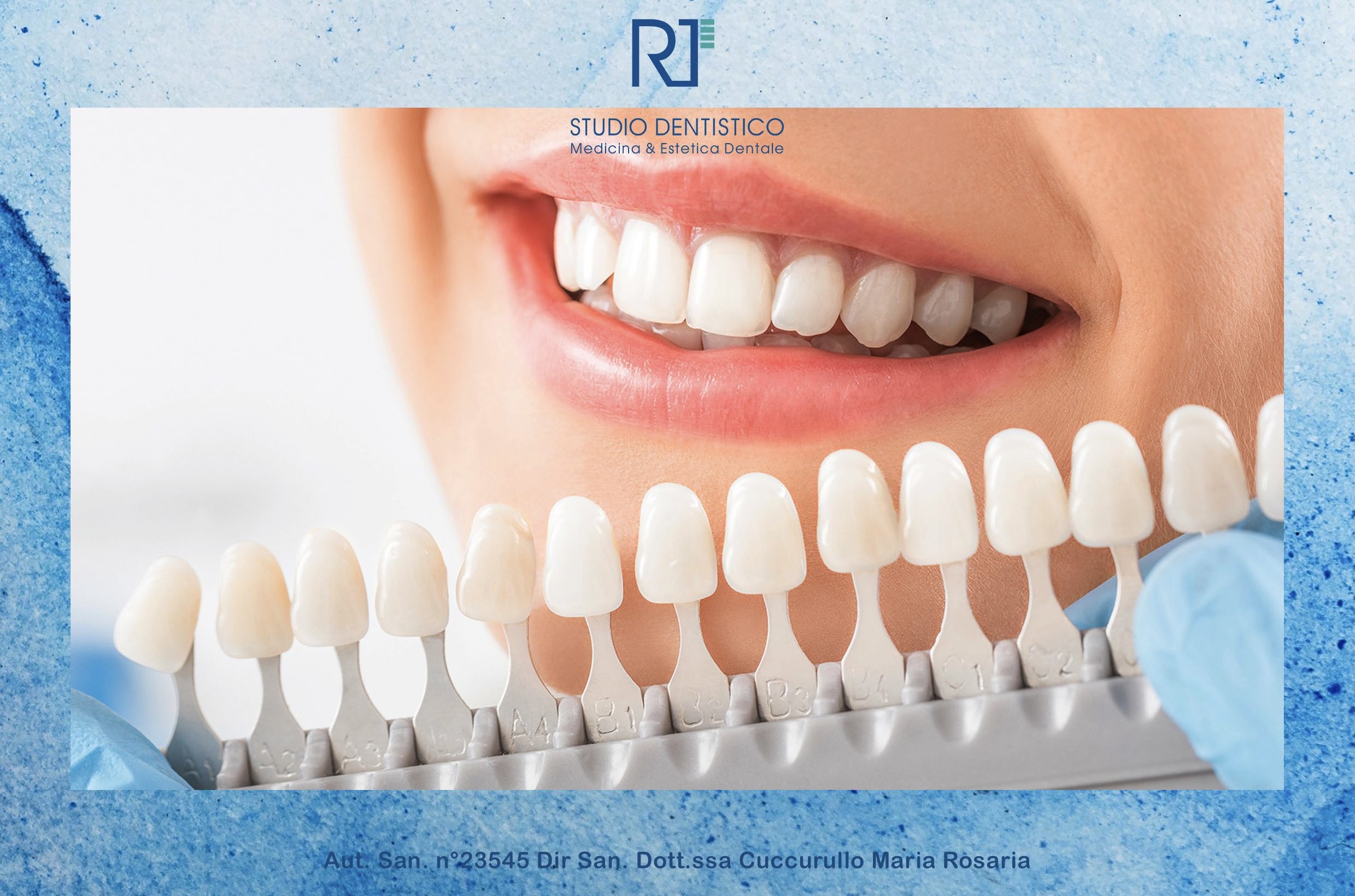 Inestetismi dei denti? Scopri cosa sono le faccette dentali