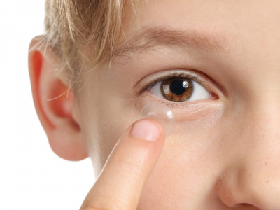 Utilizzo delle lenti a contatto in età pediatrica