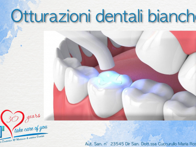 Otturazioni dentali bianche, cosa sono e la loro funzione